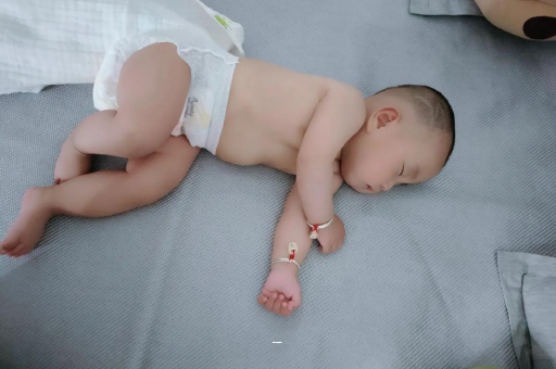 岑溪孕妇前庭大腺囊肿